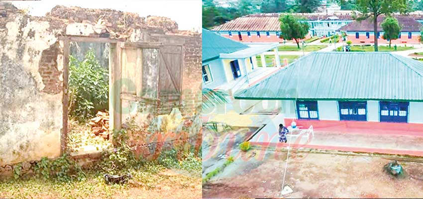 Hôpital de district de Dschang : l’étonnante métamorphose Hôpital de district de Dschang : l’étonnante métamorphose