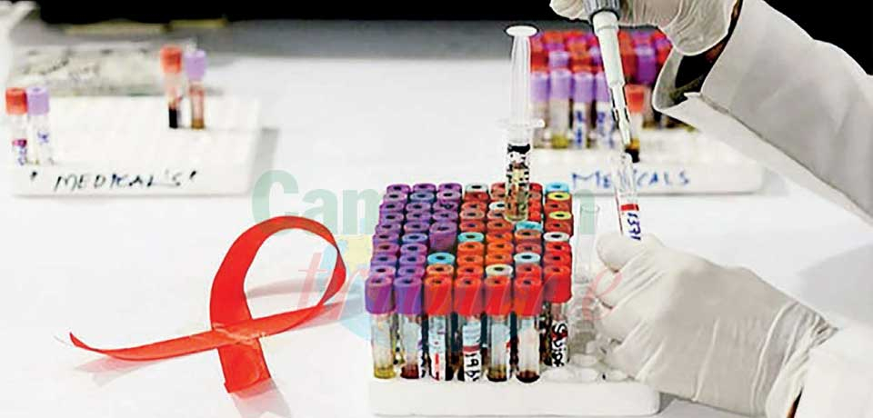 VIH/sida : gare à la banalisation !