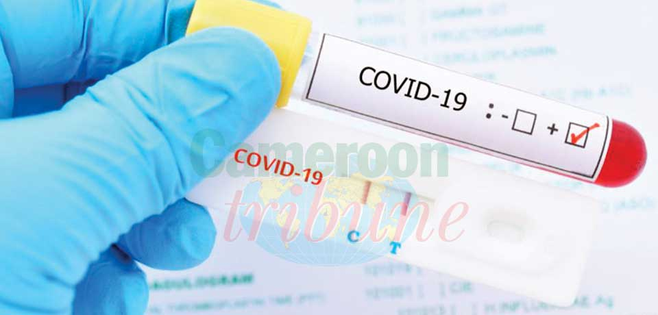 Covid-19 : AmpliQuick Making Screening Faster Covid-19 : AmpliQuick Making Screening Faster