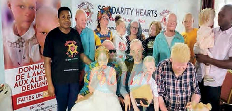 Sensibilisation  : exercice de motivation pour les albinos