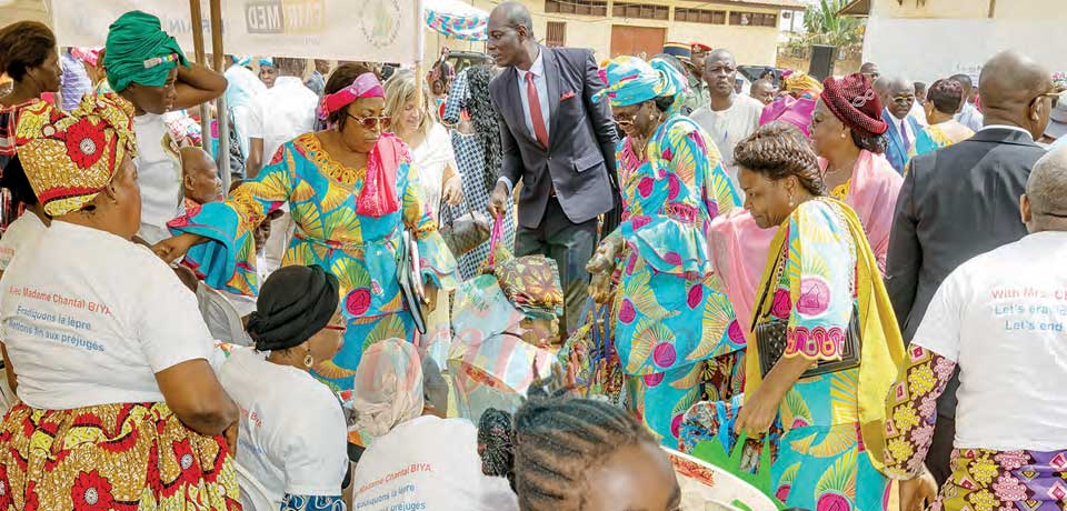 71st World Leprosy Day : CERAC Communes, Donates To Victims 71st World Leprosy Day : CERAC Communes, Donates To Victims