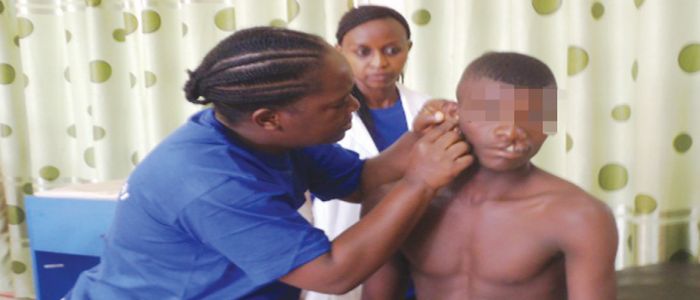 Bec de lièvre: des soins gratuits à Bafoussam Bec de lièvre: des soins gratuits à Bafoussam