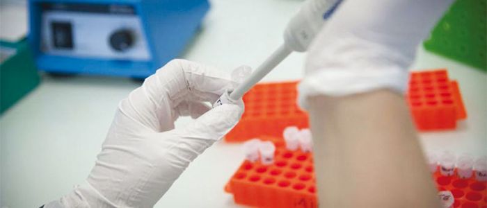 Recherche contre Ebola: des anticorps découverts